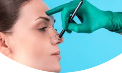 Rhinoplasty